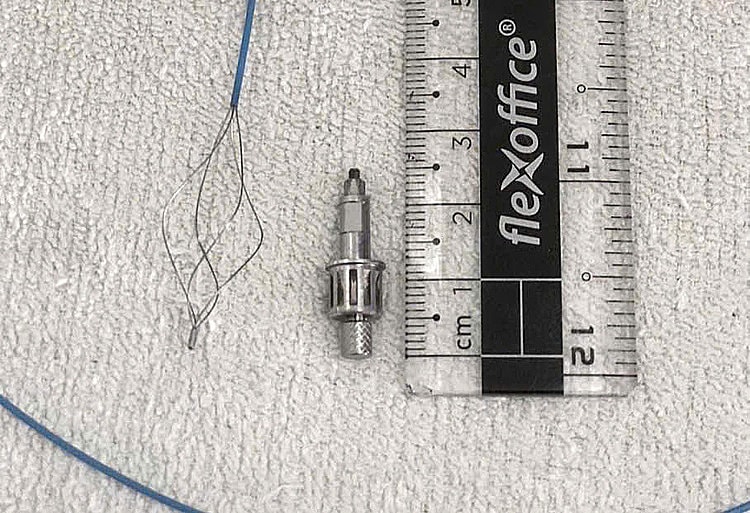 Dụng cụ nha khoa rơi vào đường thở sau khi làm răng