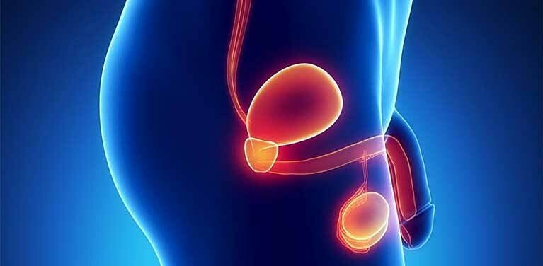 Ung thư tinh hoàn giai đoạn muộn ở tuổi 19