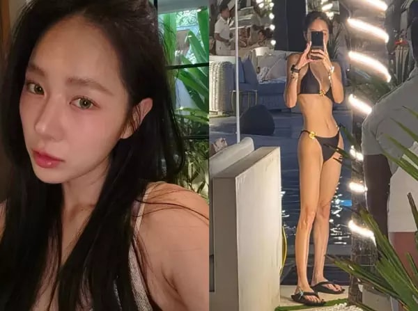 Nữ ca sĩ quá gầy sau khi giảm 10 kg