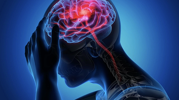 Đột quỵ khi đi vệ sinh lúc 2 giờ sáng