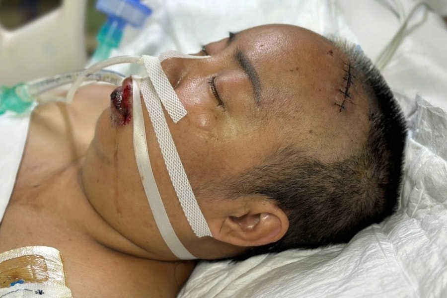 Mẹ nghèo đơn thân bán bánh nuôi con khuyết tật, nguy kịch vì xuất huyết não