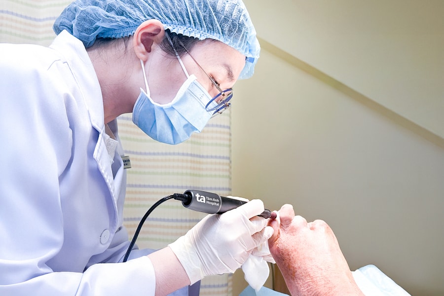 Vết loét nhỏ gây hoại tử ngón chân do biến chứng tiểu đường