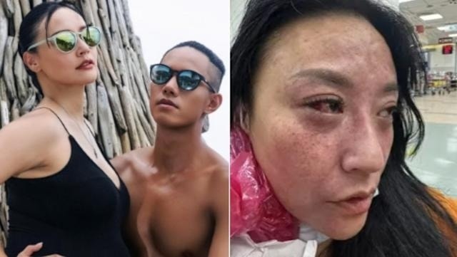 Diễn viên Tâm Vân bị chồng kém 16 tuổi bạo hành