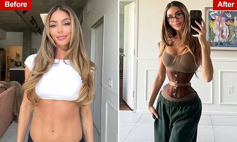 Những cô gái cắt xương sườn tìm 'eo con kiến'