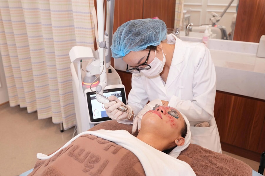 Trị nám bằng laser bao lâu thì hết?