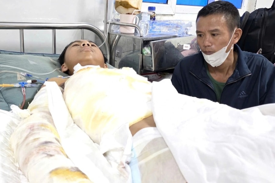 Nam sinh 14 tuổi nguy cơ phải cắt bỏ cả hai tay sau cú điện giật kinh hoàng