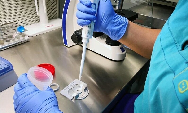 Gần 200 trẻ nhận gene ung thư từ một người hiến tinh trùng