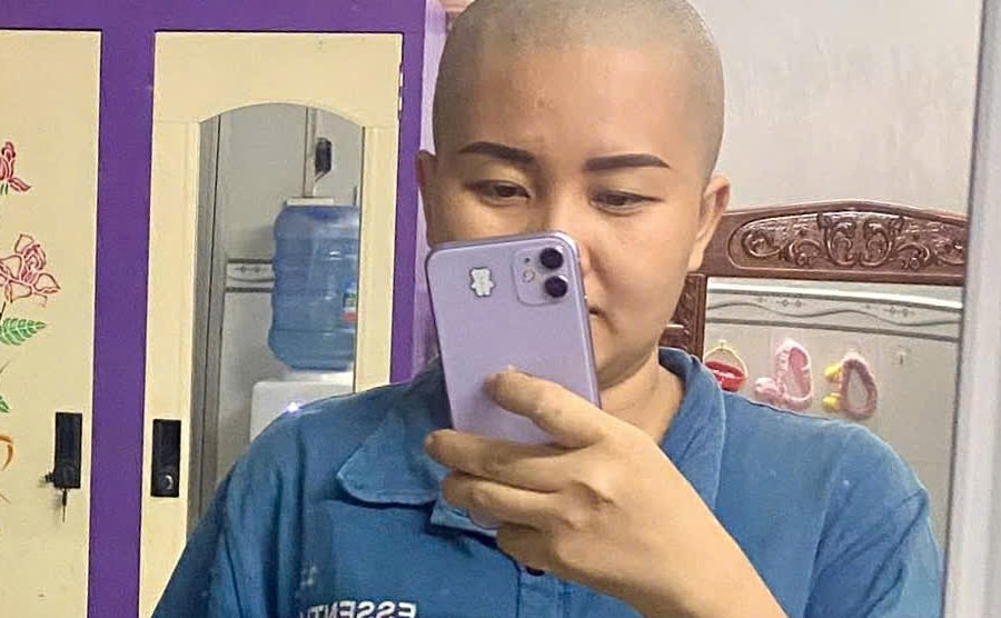 Trầm cảm sau sinh khiến người mẹ tự cạo trọc đầu