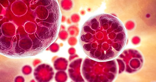 Nhiễm trùng nấm khiến 1 người nguy kịch và 18 ca mắc bệnh