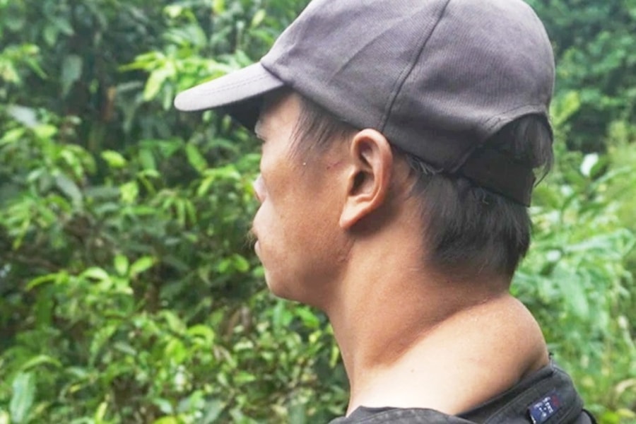 Người đàn ông bị khối u hành hạ và nỗi lo dắt bà lão chạy trốn gió mưa