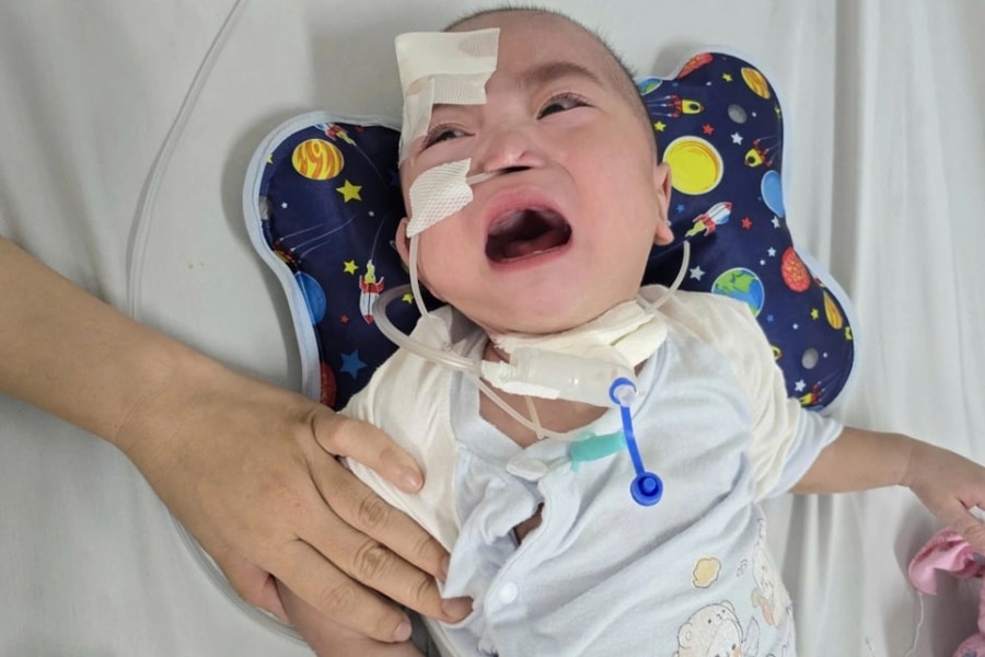 Bé trai sinh non 24 tuần thai, 14 tháng tuổi vẫn chưa thể tự thở