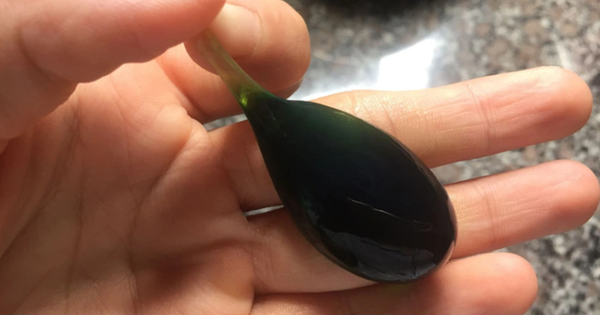 Người đàn ông 38 tuổi suýt chết vì nuốt mật cá trắm để "tăng cường sinh lực"