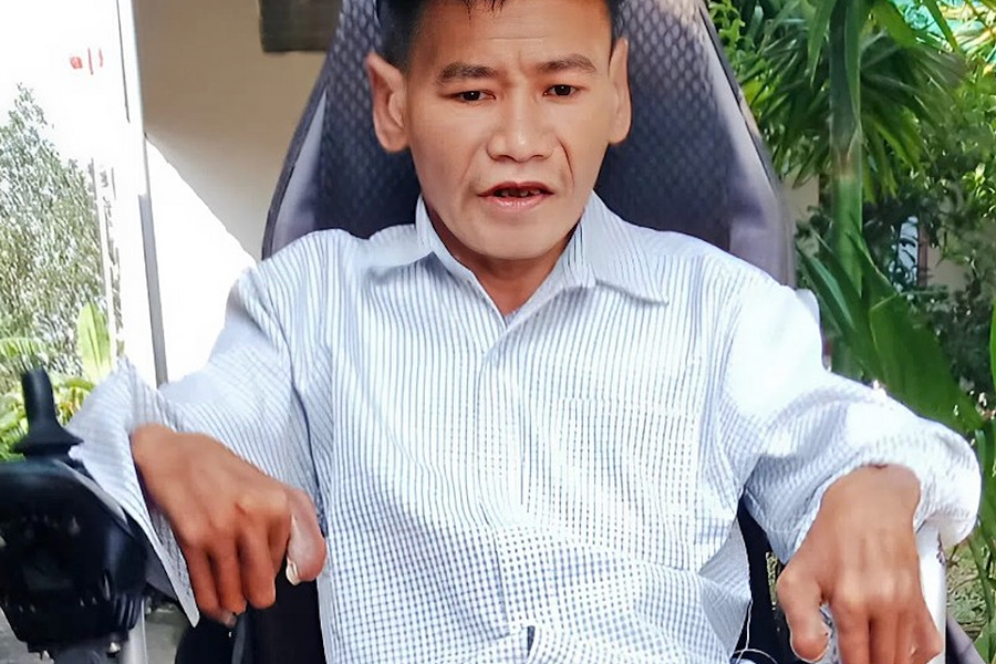 Nửa thế kỷ sống trong hình hài 'người cây'