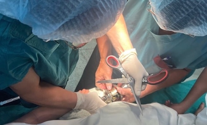 Bác sĩ phá ổ khóa cửa giải cứu ngón tay bé 5 tuổi