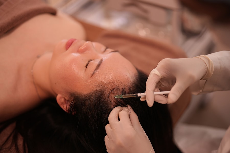 Ai không nên tiêm meso chữa rụng tóc?