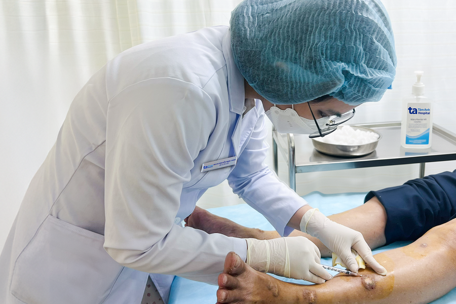 Sẩn cục khắp tay chân do viêm da mạn tính