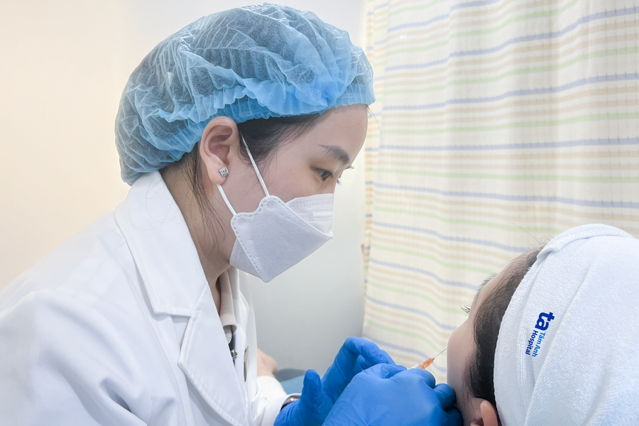 Tiêm HA làm đầy hốc mắt trũng sâu