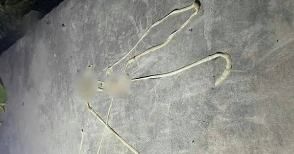 Bị rối loạn tiêu hóa, người đàn ông phát hiện "vật thể lạ" dài gần 10m