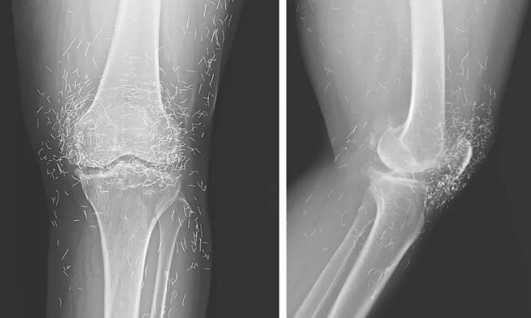 10 ca bệnh 'thách thức chẩn đoán' y khoa thế giới