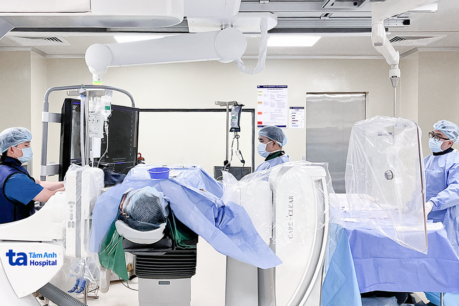 Rò động mạch cảnh - xoang hang trong não