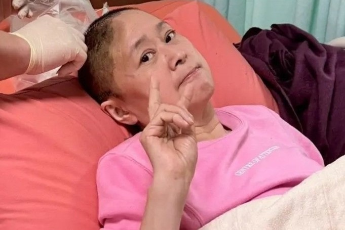 Diễn viên 'Vườn sao băng' bị ngã, mất một phần hộp sọ