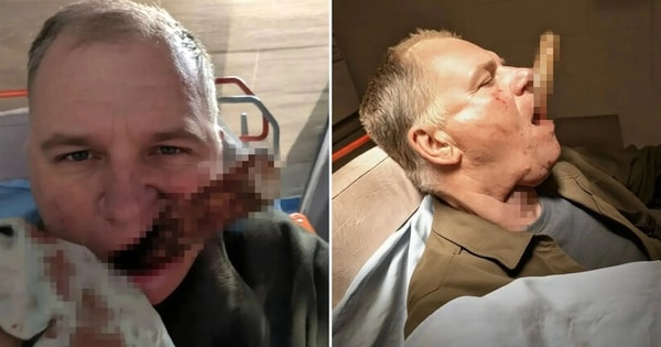 Trượt chân khi lao động, người đàn ông gặp tai nạn nghiêm trọng