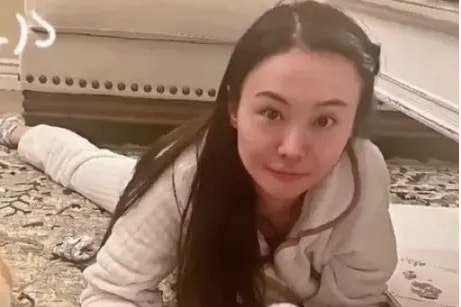 Gương mặt biến dạng của Trịnh Sảng gây xôn xao