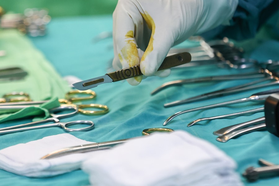 Lửa bùng lên từ quả pháo nổ đốt mặt bé trai cháy đen