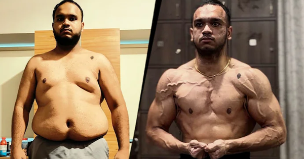 Nam thanh niên nặng 127 kg "lột xác" ngoạn mục nhờ phương pháp "lạ"