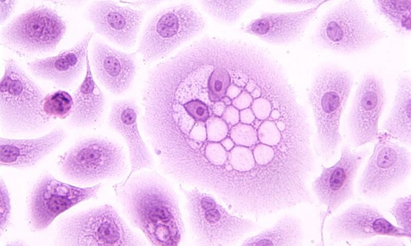 Hiểu đúng về vaccine HPV qua 5 thắc mắc thường gặp