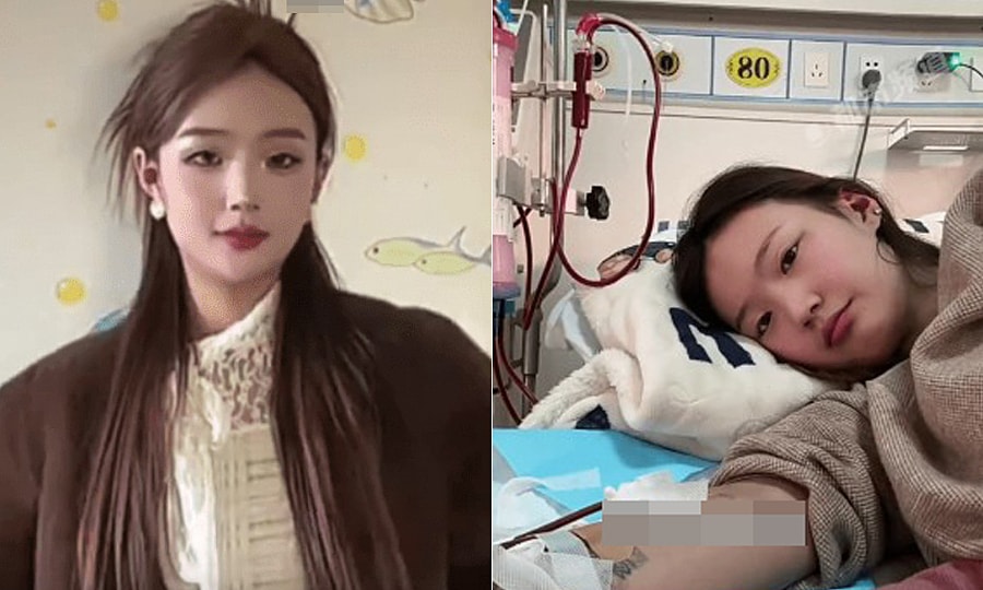 Tăng gần 30 kg, tưởng béo phì hóa ra suy thận giai đoạn cuối