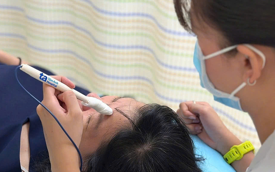 Liệt dây thần kinh số 7 do lạnh