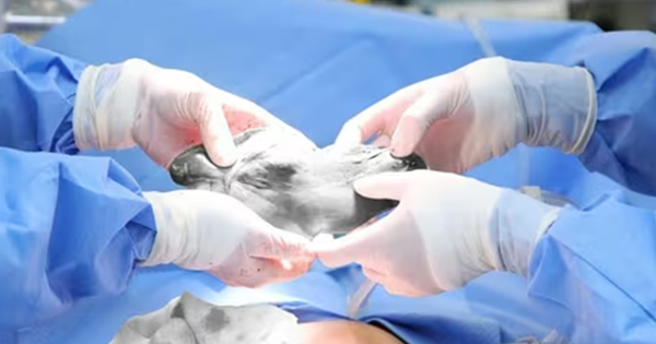 Đau bụng kéo dài, người phụ nữ đi khám phát hiện bí mật đáng sợ