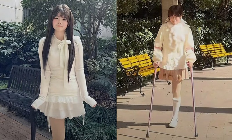 Cô gái ung thư xương bị gia đình bỏ rơi, tự ký giấy phẫu thuật