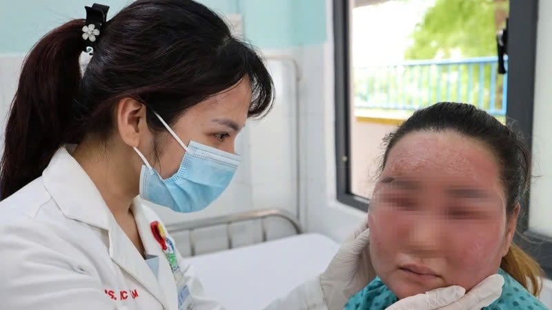 Cảnh báo rủi ro từ các dịch vụ làm đẹp cấp tốc dịp Tết