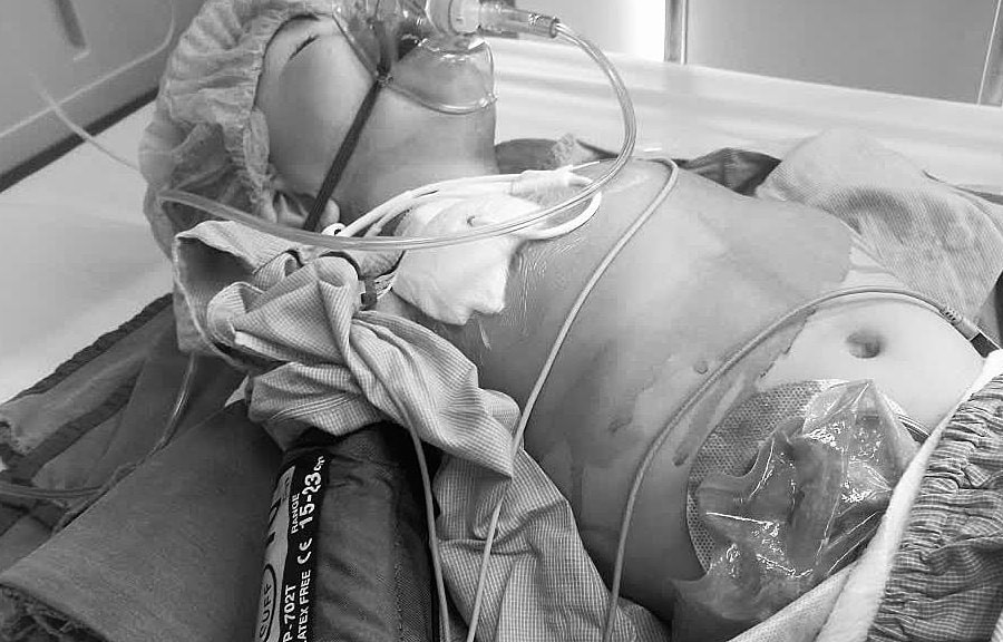 Cơ hội sống duy nhất của cậu bé bị đột biến gene