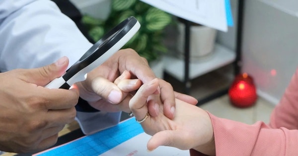 Da đỏ sậm, bong tróc khi trời lạnh, người phụ nữ Hà Nội phải cầu cứu bác sĩ