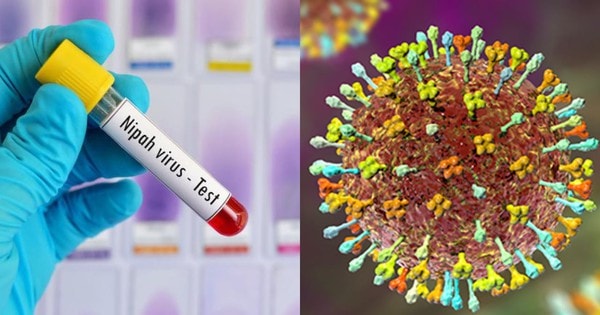 Bộ Y tế hoả tốc yêu cầu cơ sở khám chữa bệnh chủ động phòng chống bệnh do virus Nipah