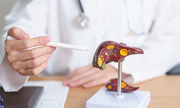 Bác sĩ giải mã hiện tượng khối u gan 6 cm tự 'bốc hơi'