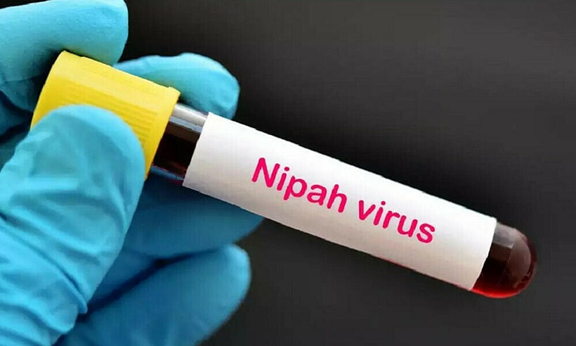 Dấu hiệu nhiễm virus Nipah dễ nhầm với cảm cúm