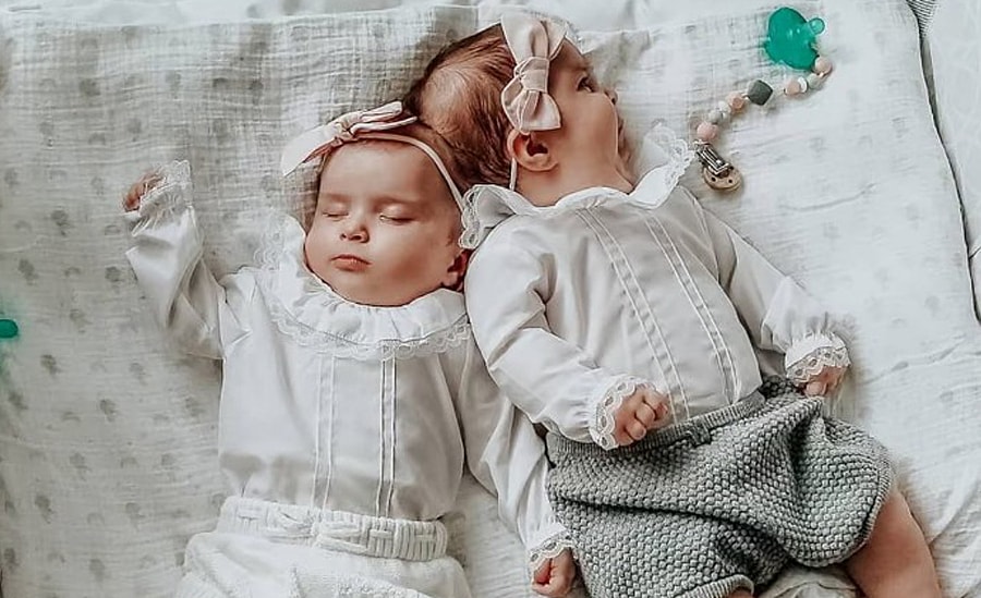 Cuộc sống của cặp song sinh dính đầu sau 6 năm tách rời