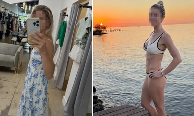 Giới nhà giàu New York chi hàng chục nghìn USD tiêm mỡ người chết