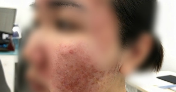 Cơn ác mộng của thiếu nữ chỉ sau vài giờ được mời làm đẹp cấp tốc đón Tết