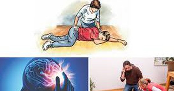 Đột quỵ não gia tăng và những dấu hiệu cảnh báo