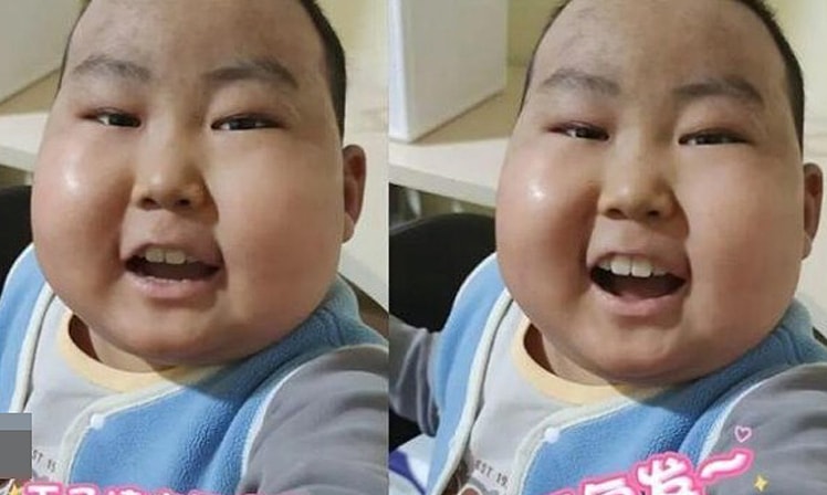 Cậu bé ung thư coi thuốc đắng là 'món tráng miệng'