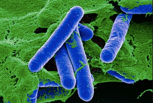 Bộ Y tế cảnh báo độc tố 'hủy hoại thần kinh' trong đồ ủ chua, đóng hộp