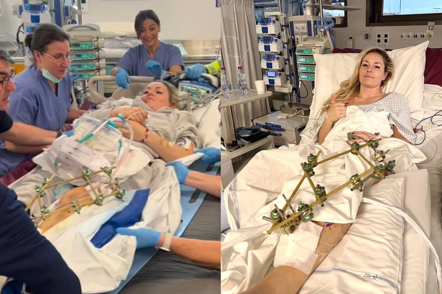 Gặp nạn ở Olympic, huyền thoại trượt tuyết Lindsey Vonn nguy cơ bị cắt cụt chân