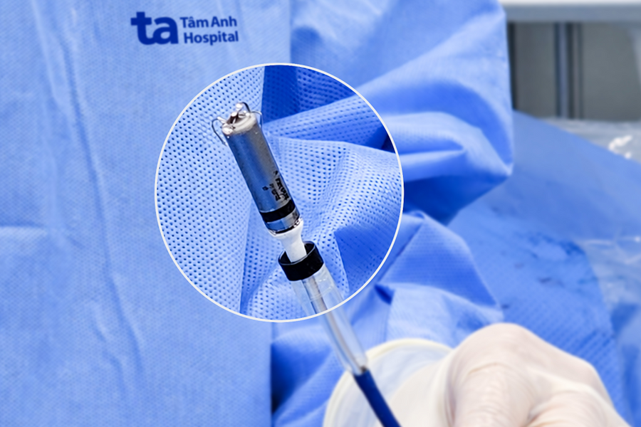 Bệnh viện Tâm Anh cấy máy tạo nhịp tim không dây thế hệ mới