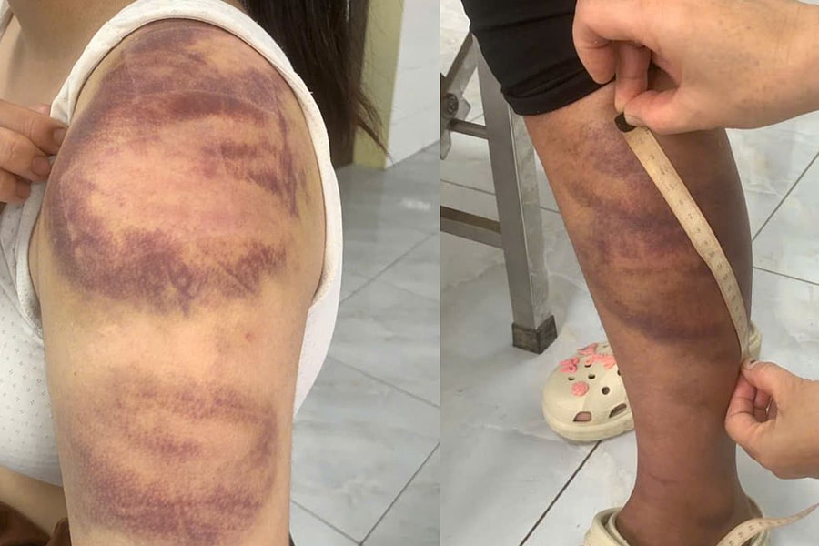 Đánh con gái và vợ mang thai 'như thời trung cổ'