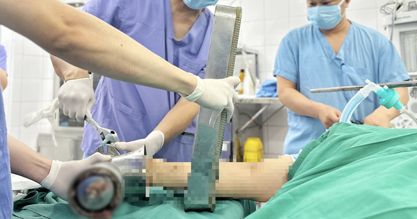 Một phút bất cẩn bên máy xay thịt, người phụ nữ trẻ phải trả giá đắt